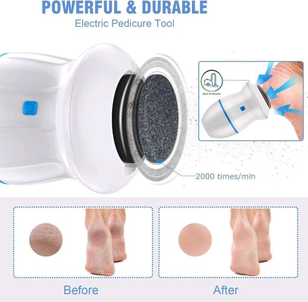 Electric Foot Callus Remover Foot Grinder Foot File Scrubber Shaver Sander Vacuum Adsorption Pedicure Tools (random Colour)